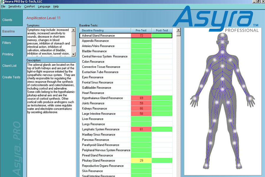 asyra electro dermal screening nhsoa-asyra-screen